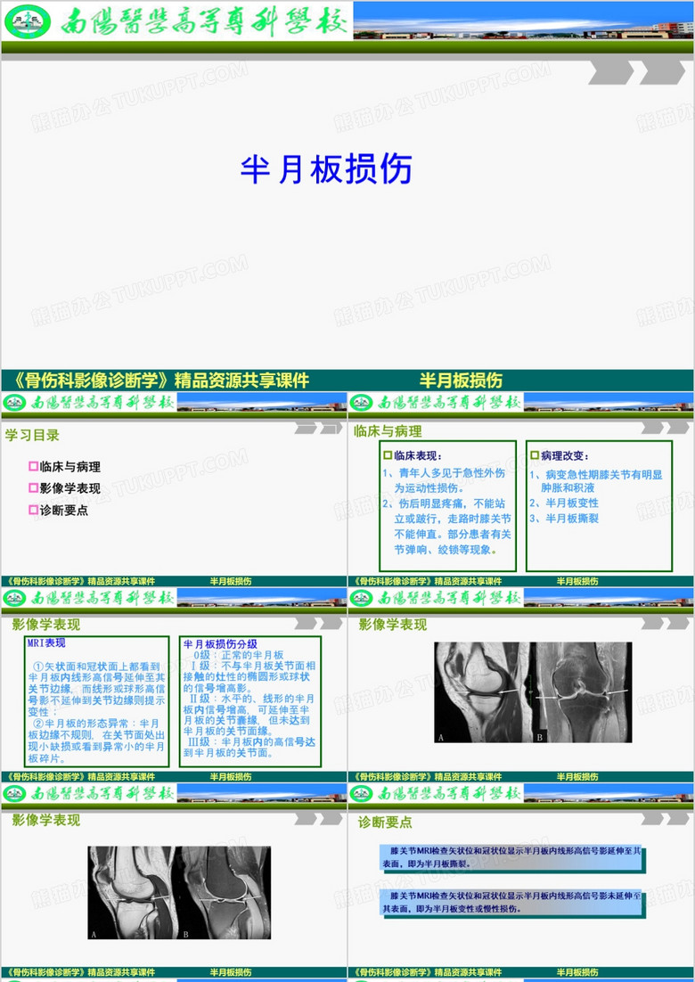 半月板损伤