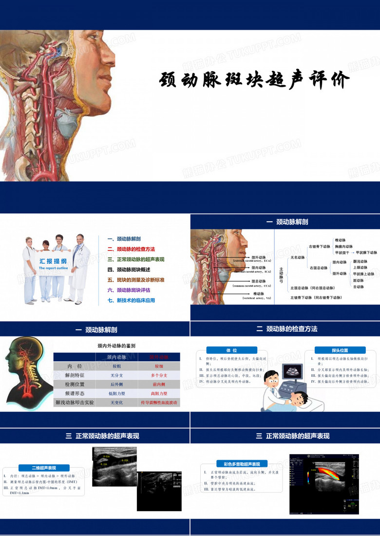 颈动脉斑块超声评价