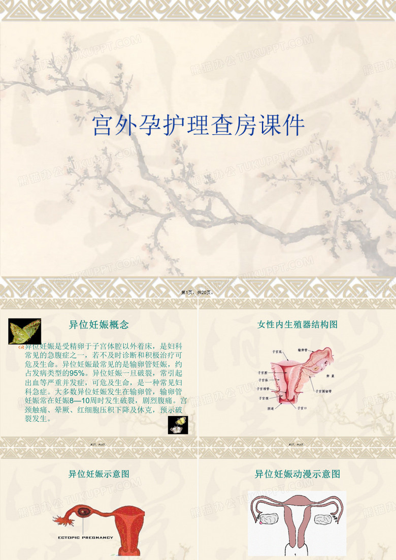 宫外孕护理查房课件