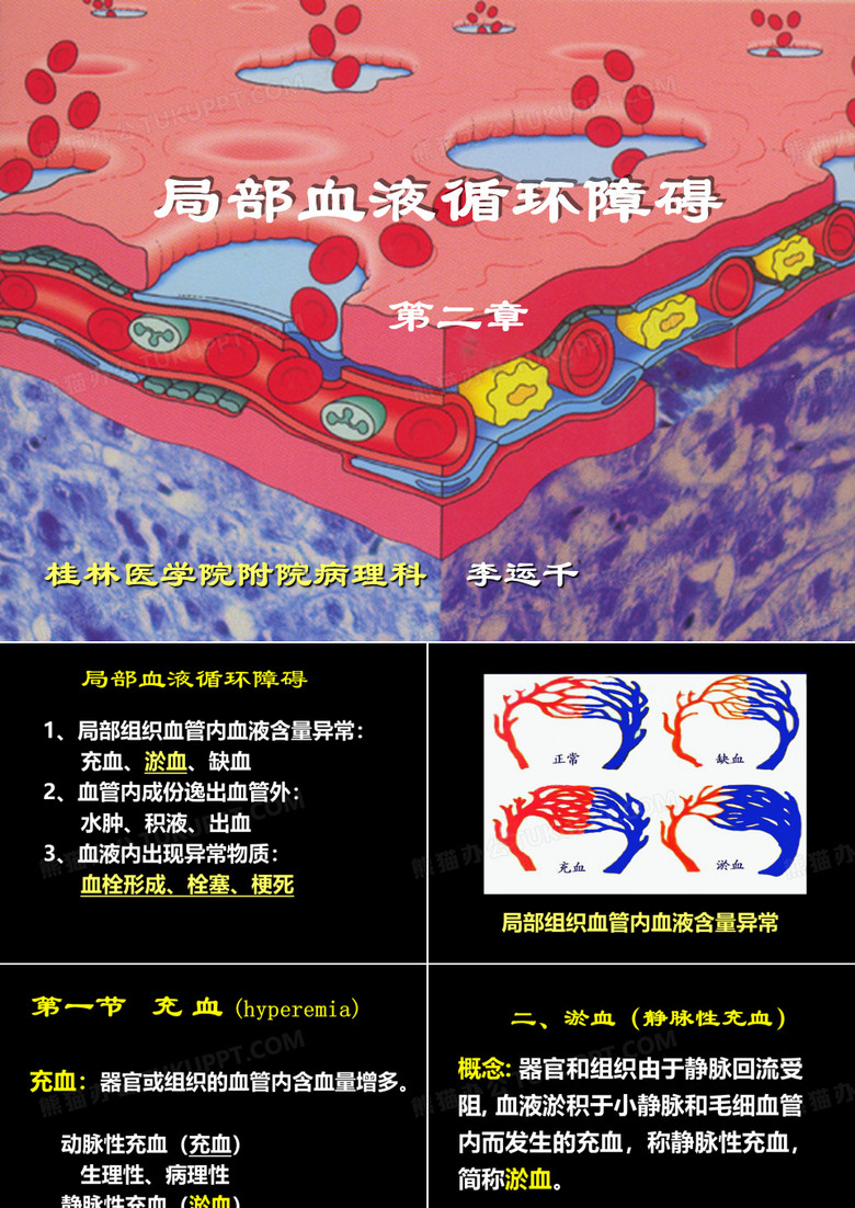 局部血液循环障碍