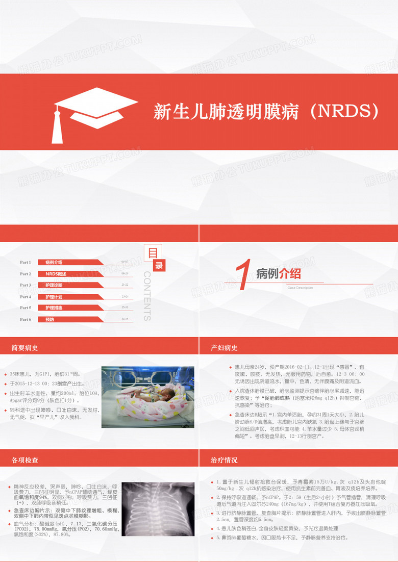 新生儿肺透明膜病