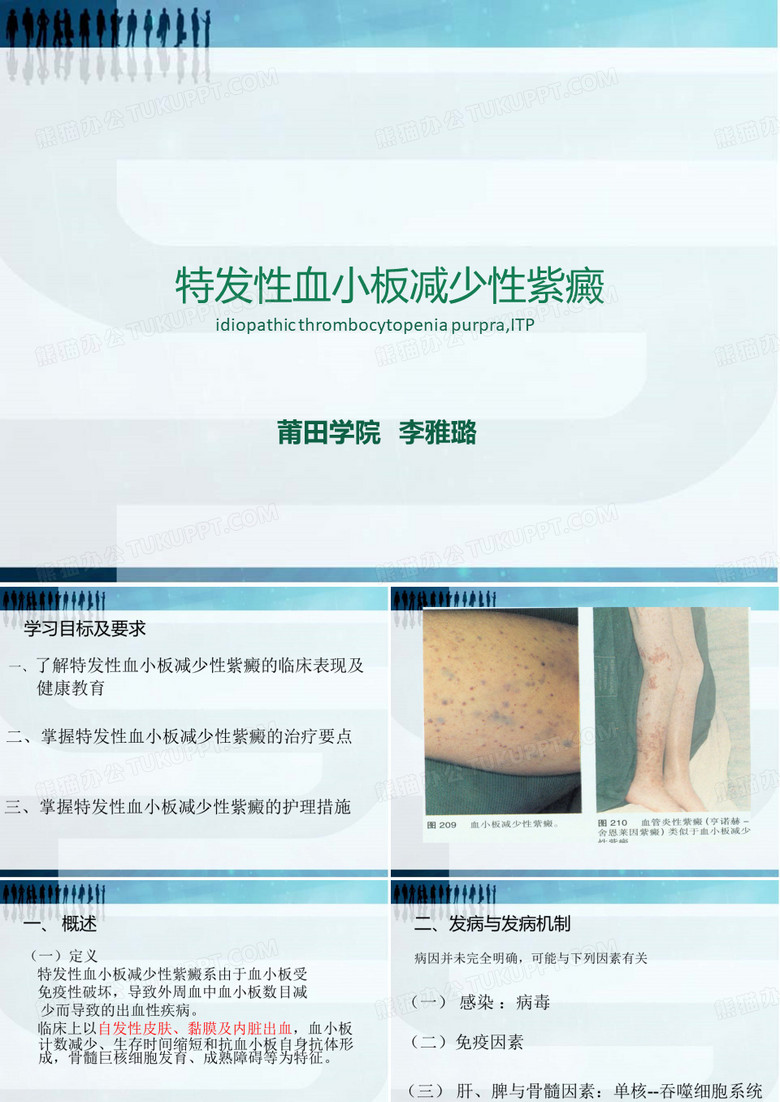 特发性血小板减少性紫癜1