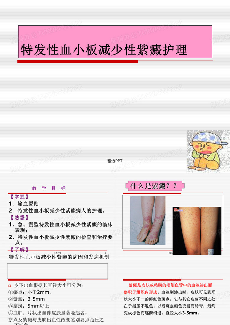 特发性血小板减少性紫癜的护理