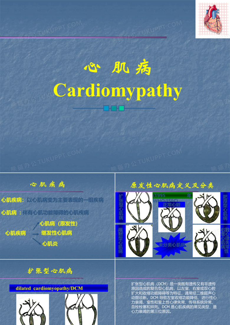 心肌病