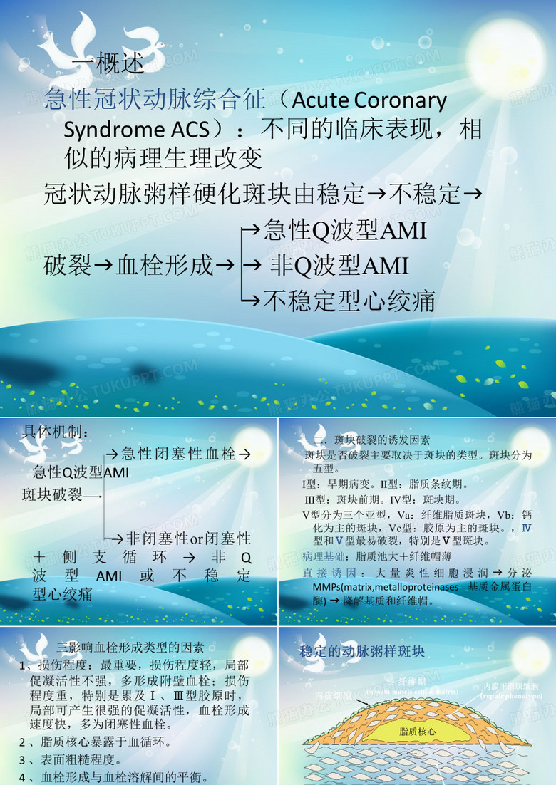 急性冠脉综合征课件