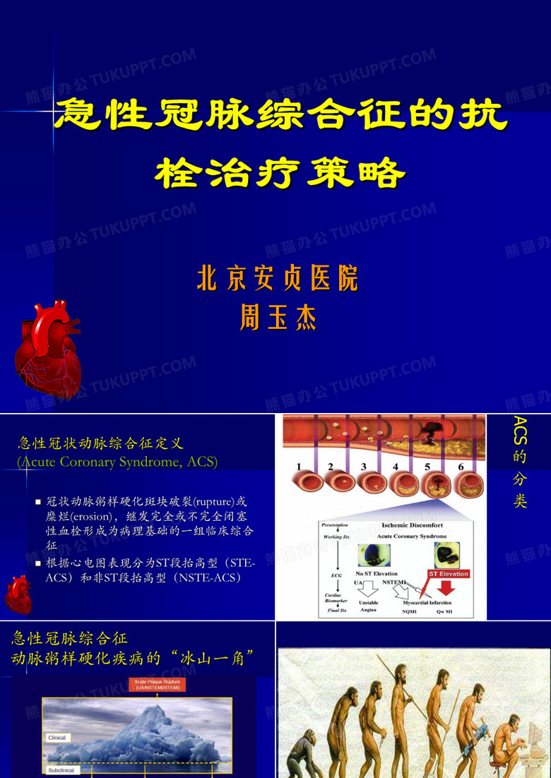 急性冠脉综合征