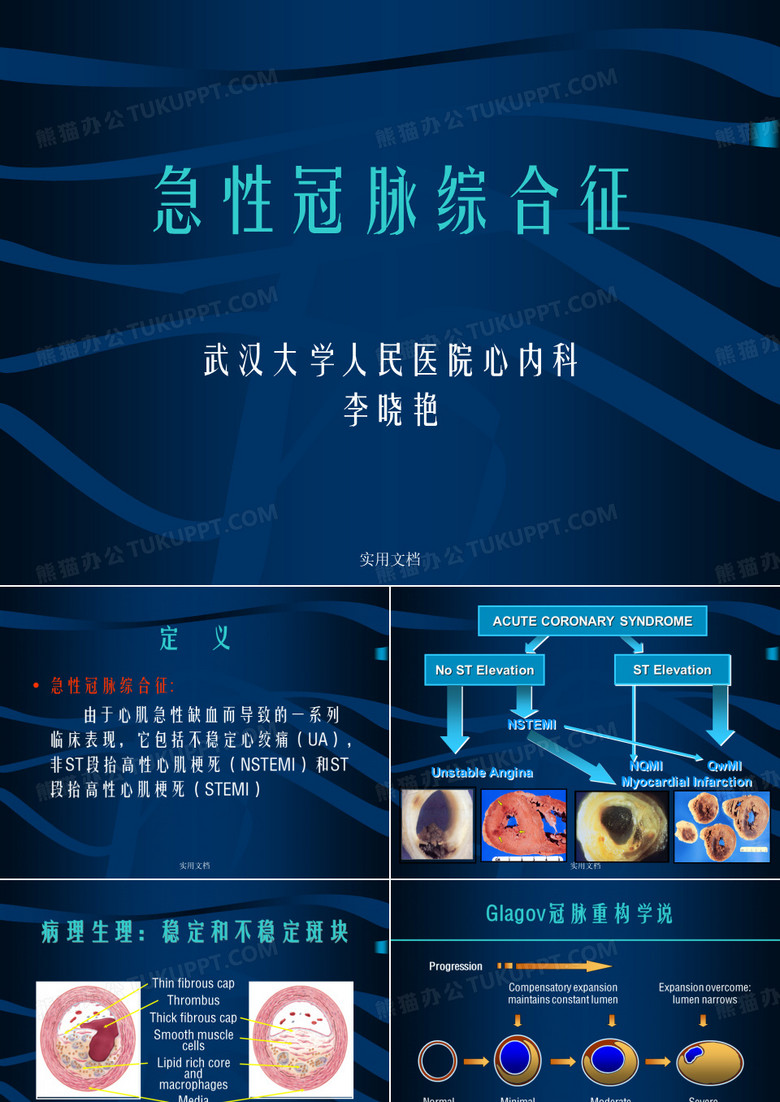 急性冠脉综合征