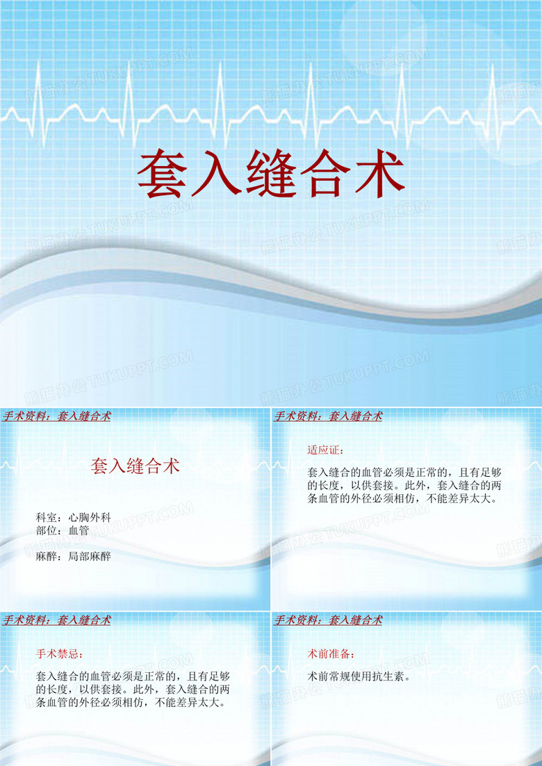 手术讲解模板：套入缝合术