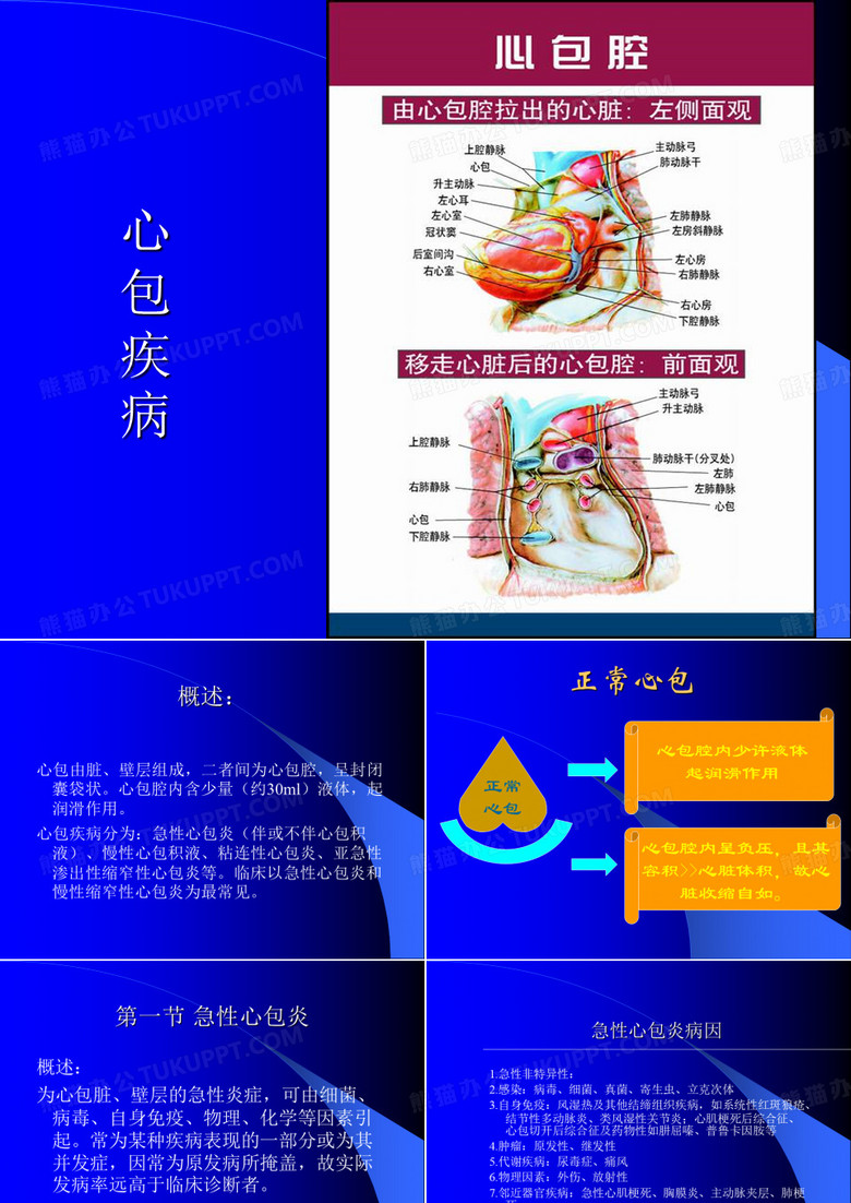 心包炎
