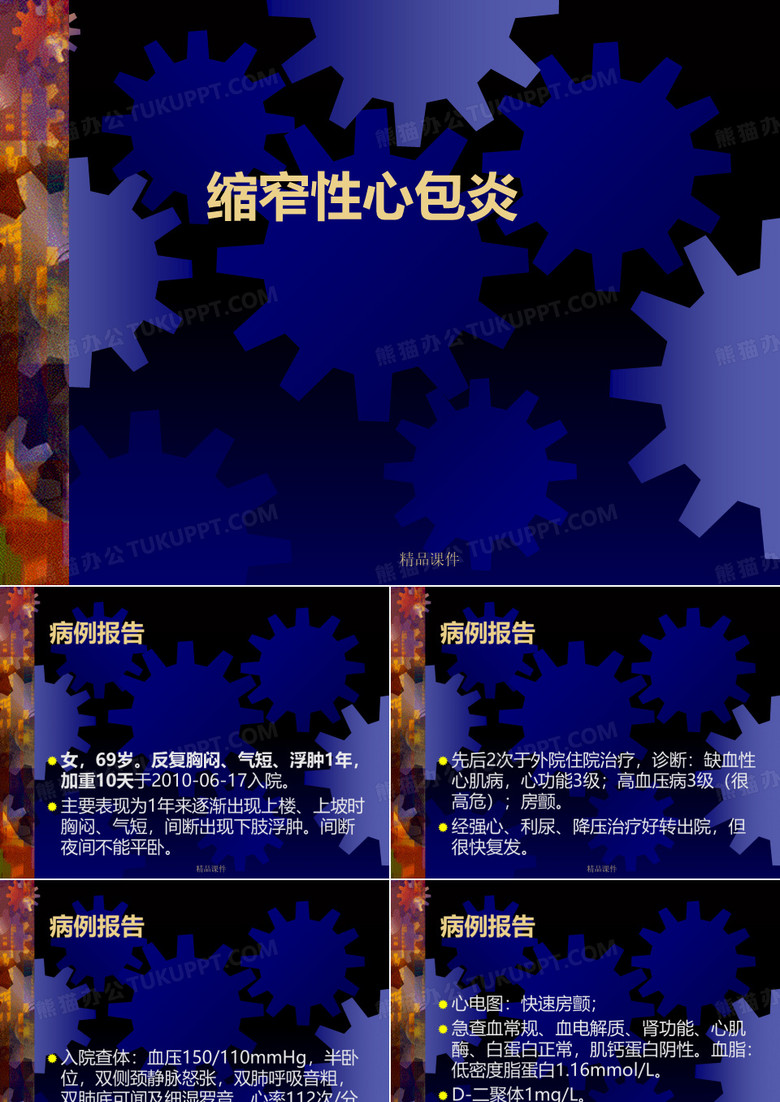 缩窄性心包炎