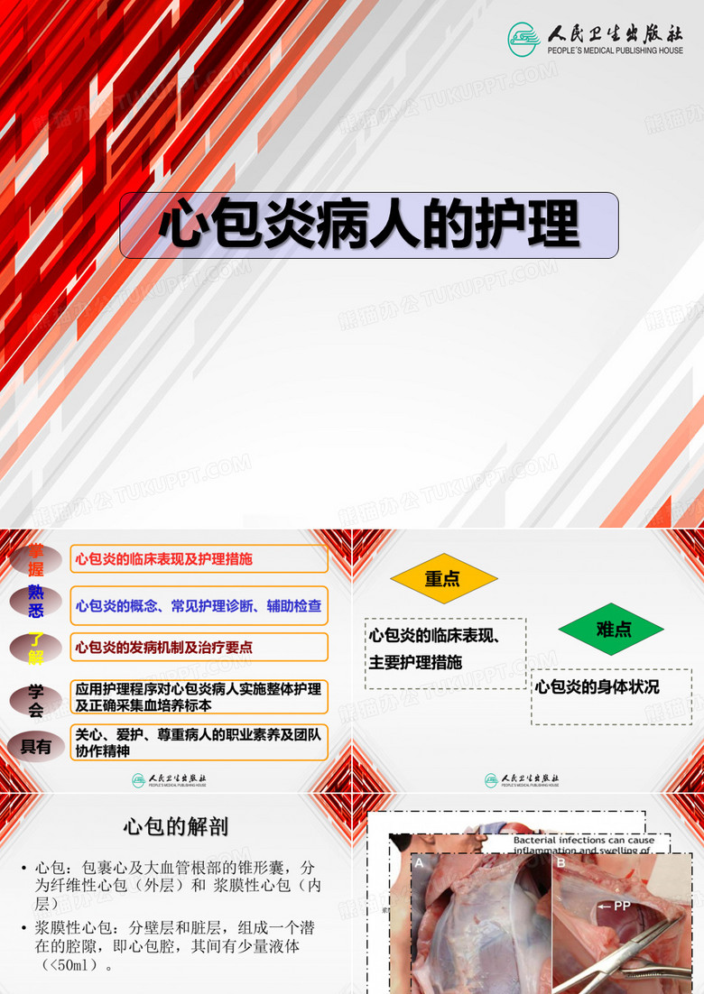 心包炎病人的护理