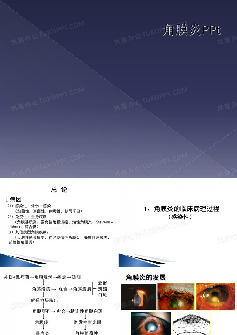 角膜炎PPt