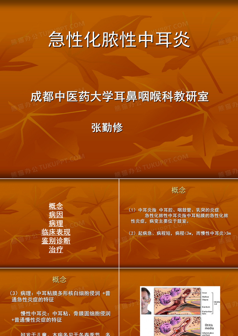 急性中耳炎
