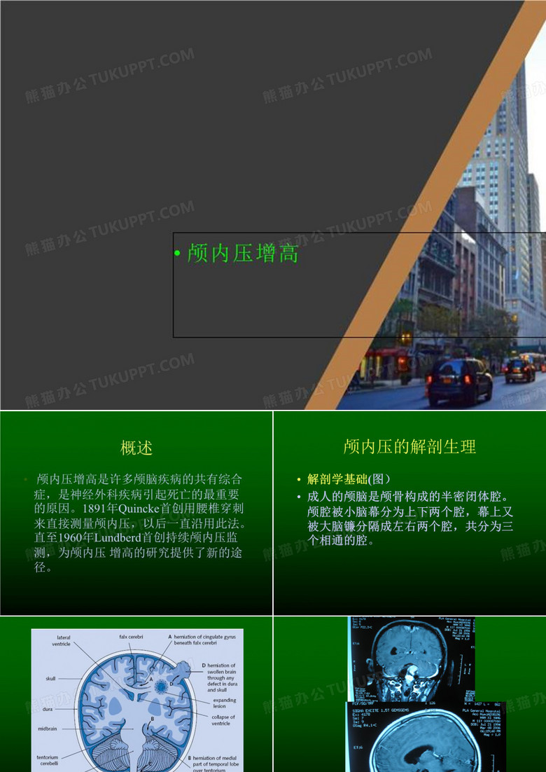 颅内压增高
