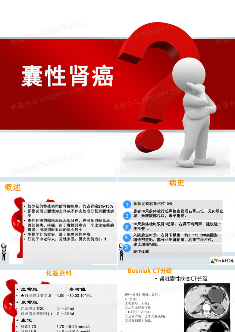 囊性肾癌