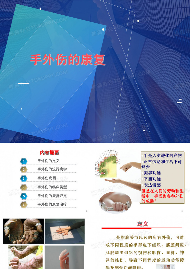 手外伤的康复