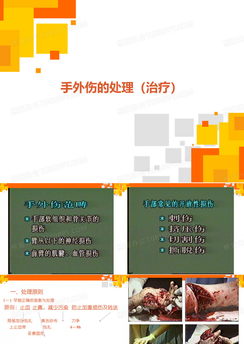 手外伤的处理
