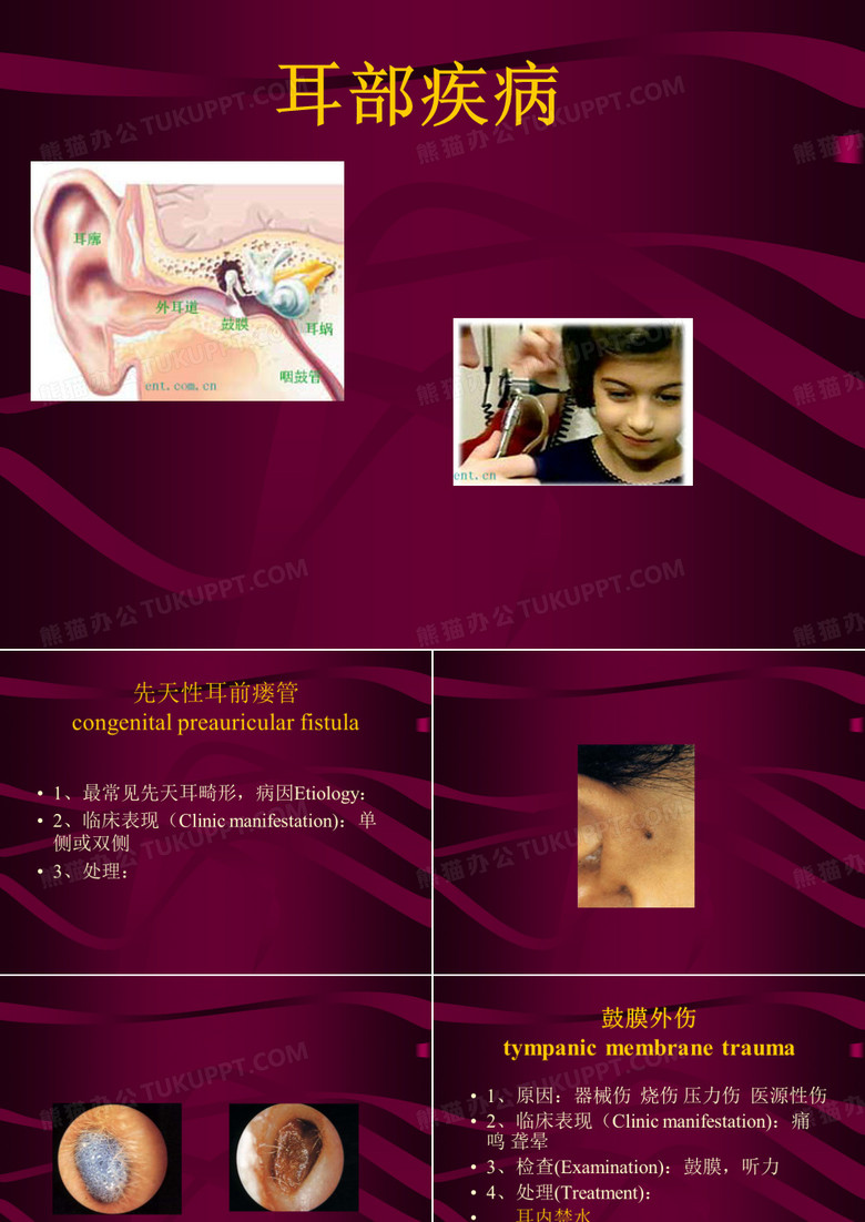 中耳炎