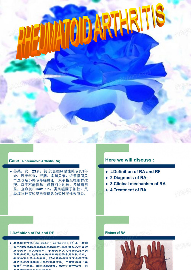 类风湿性关节炎