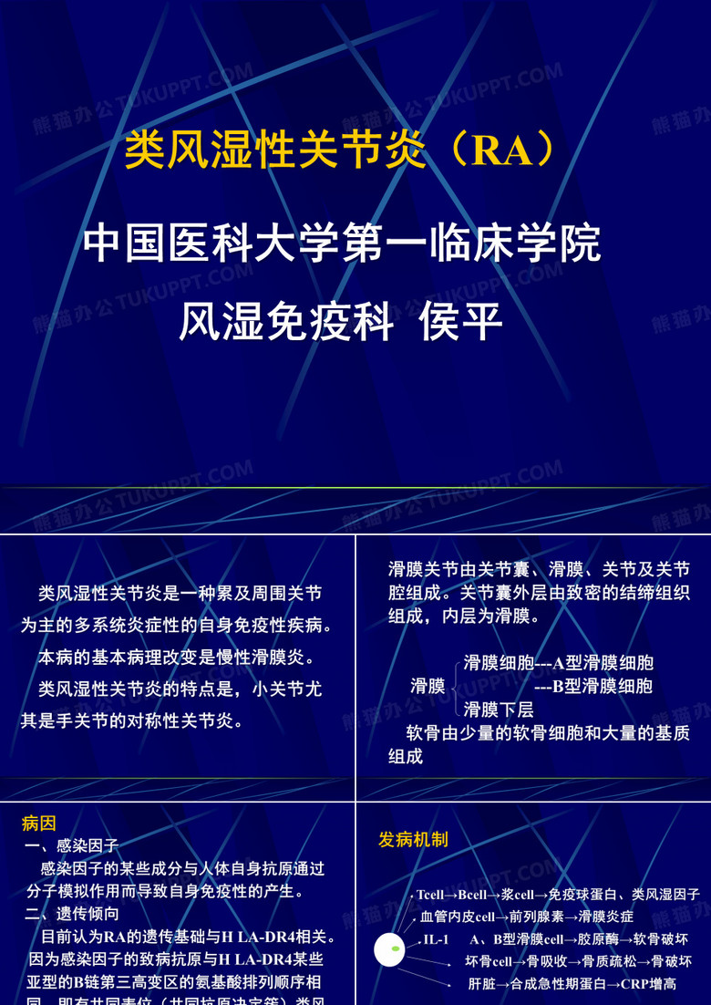 类风湿性关节炎