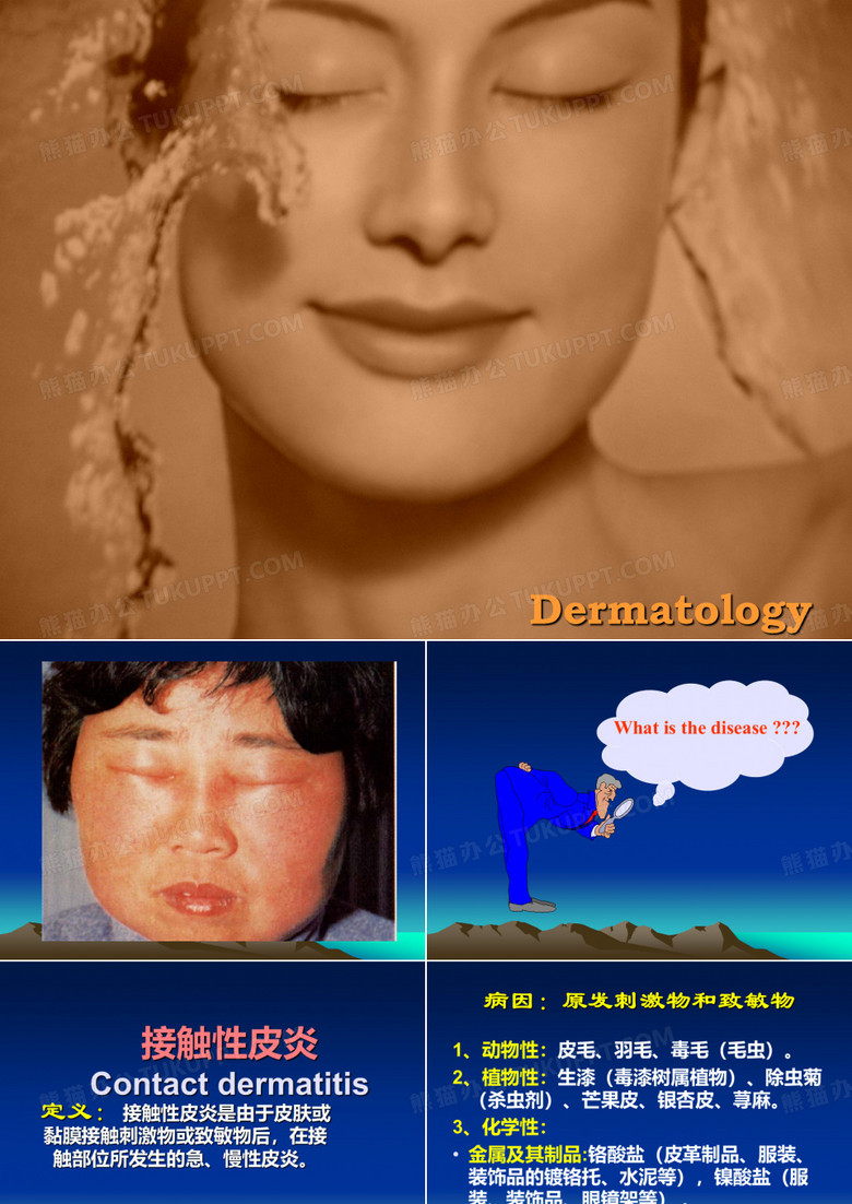 接触性皮炎