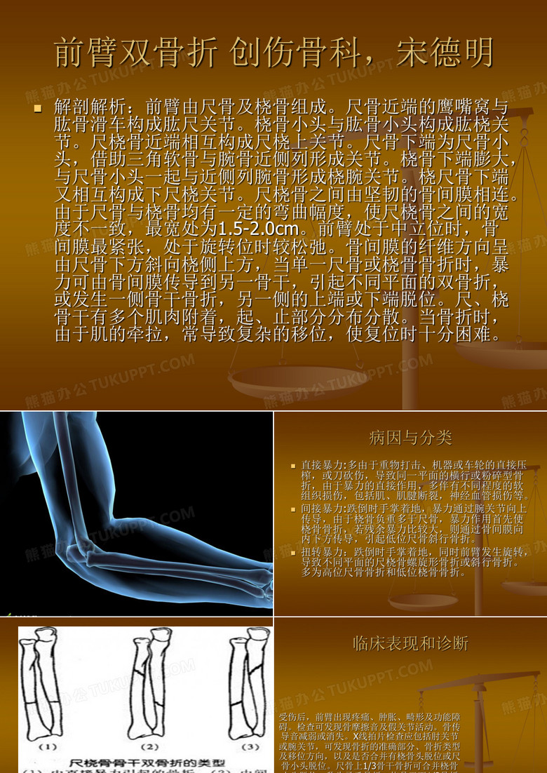 前臂双骨折