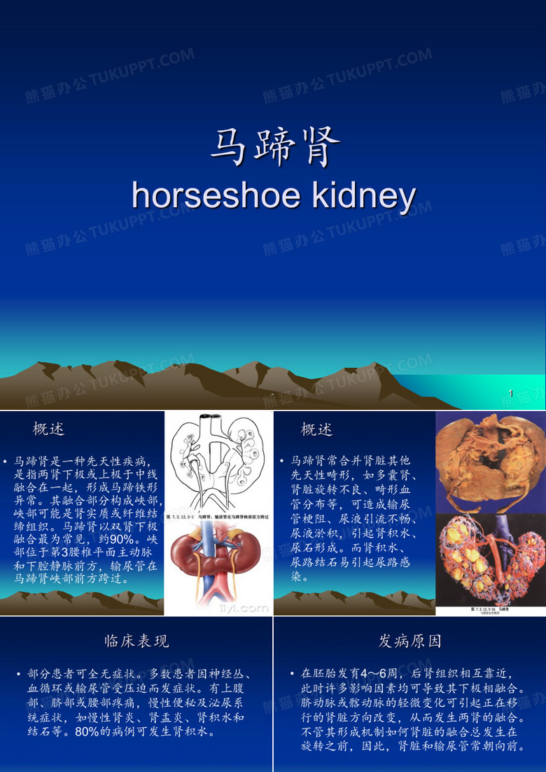 马蹄肾ppt课件