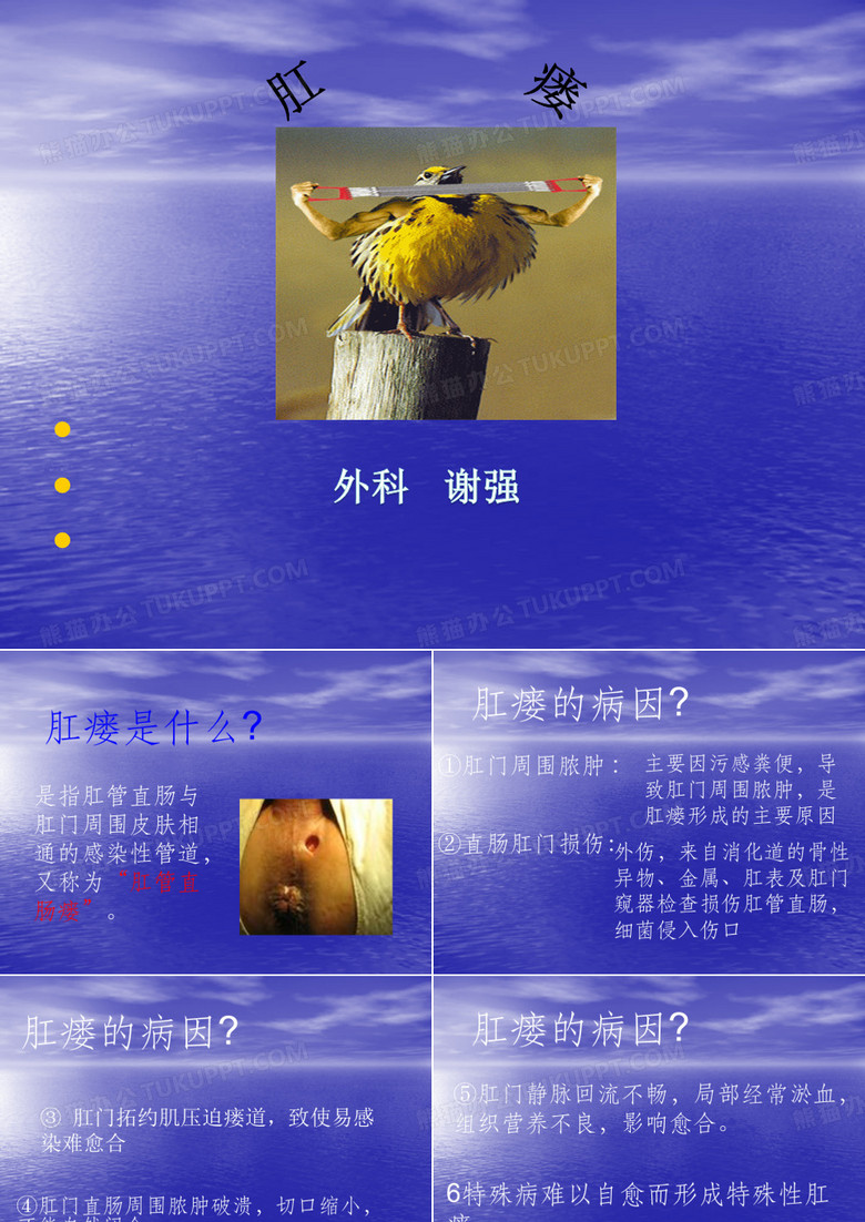 肛瘘