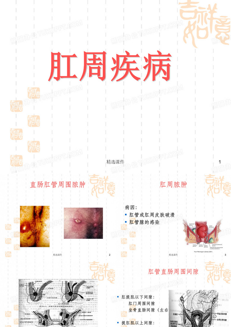 肛瘘课件