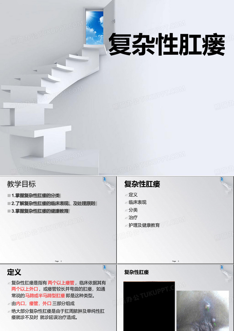 复杂性肛瘘
