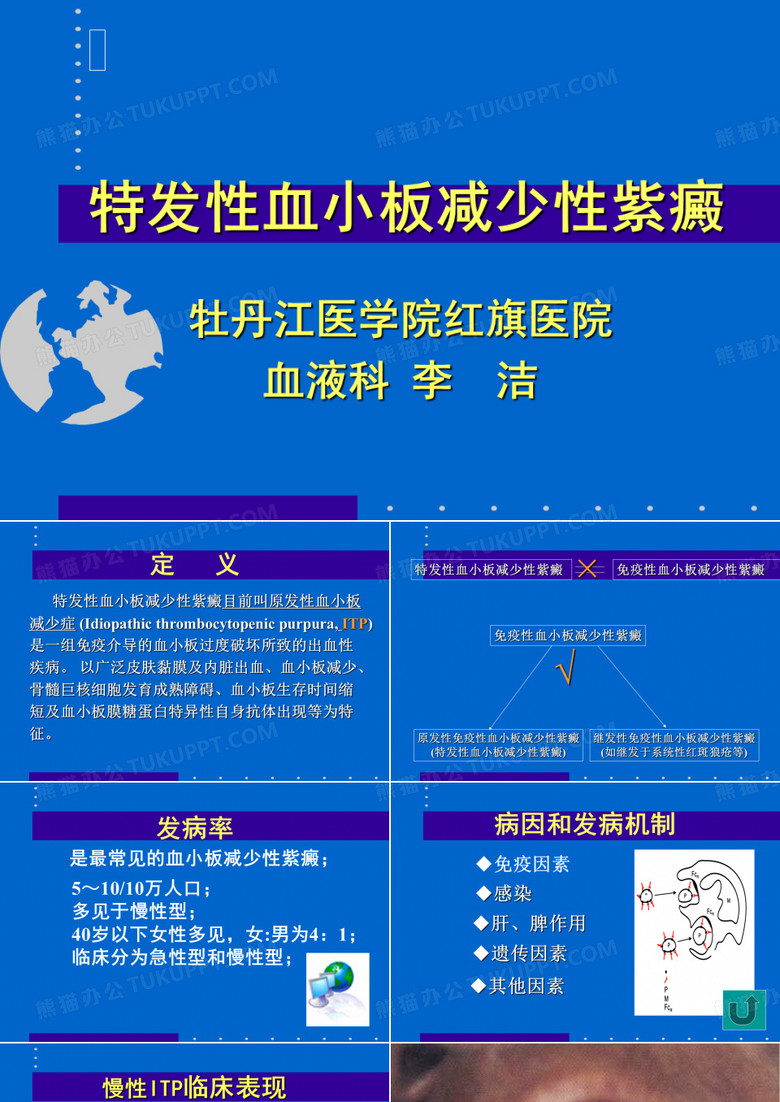 特发性血小板减少性紫癜