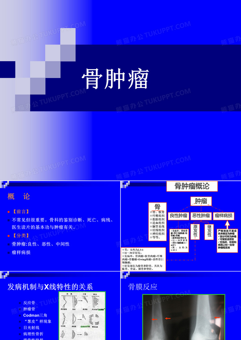 骨肿瘤课件