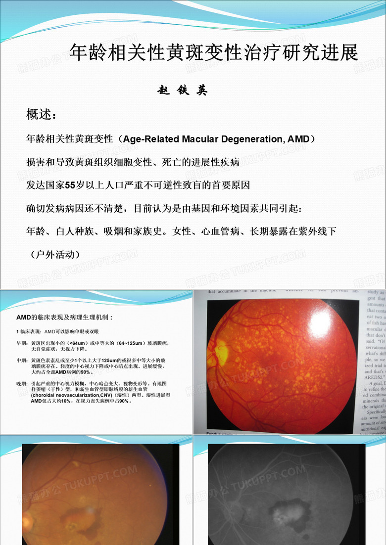 AMD的药物治疗