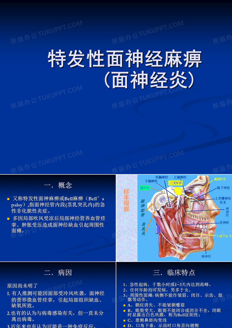 特发性面神经麻痹(面神经炎)PPT