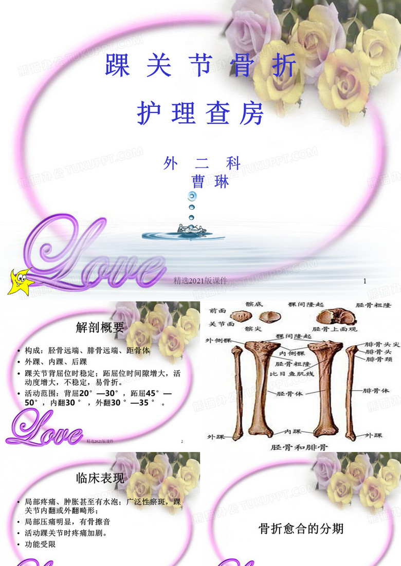 踝关节骨折护理查房