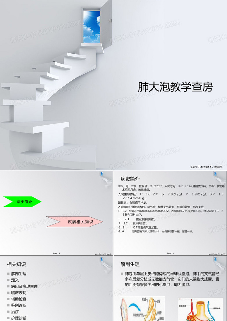 肺大泡教学查房