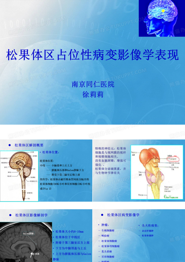 松果体区病变影像学表现