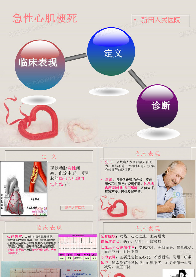 急性心肌梗塞护理查房-PPT文档