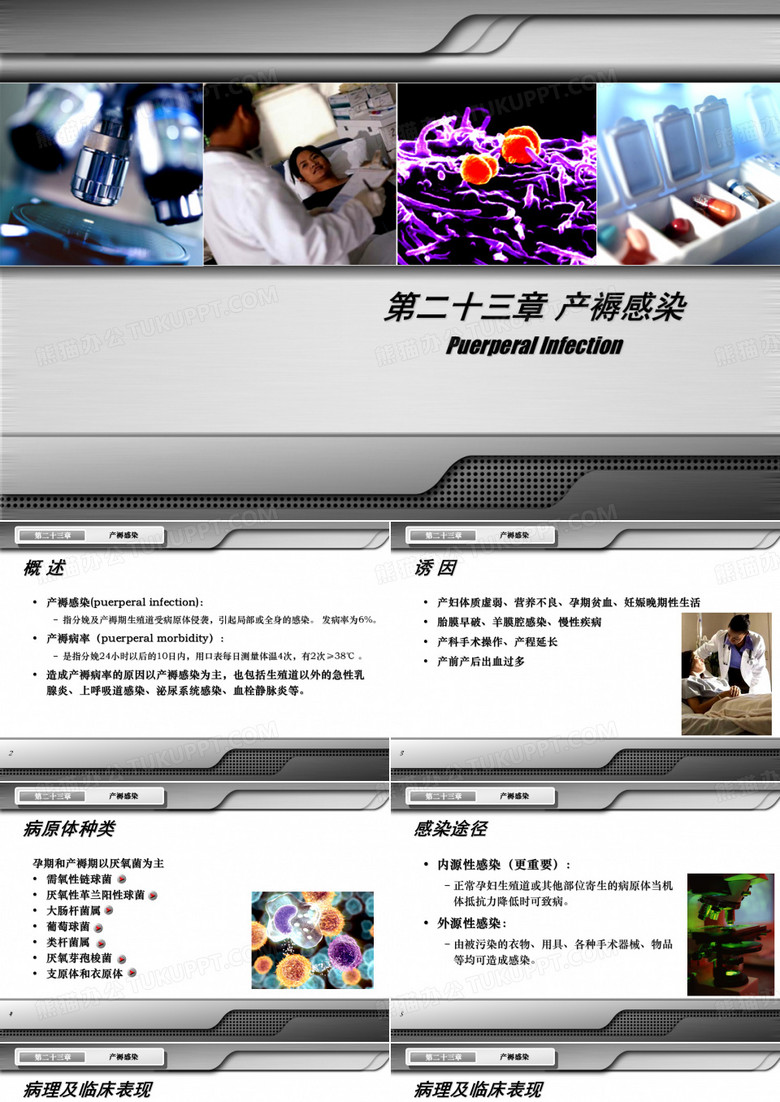 产褥感染