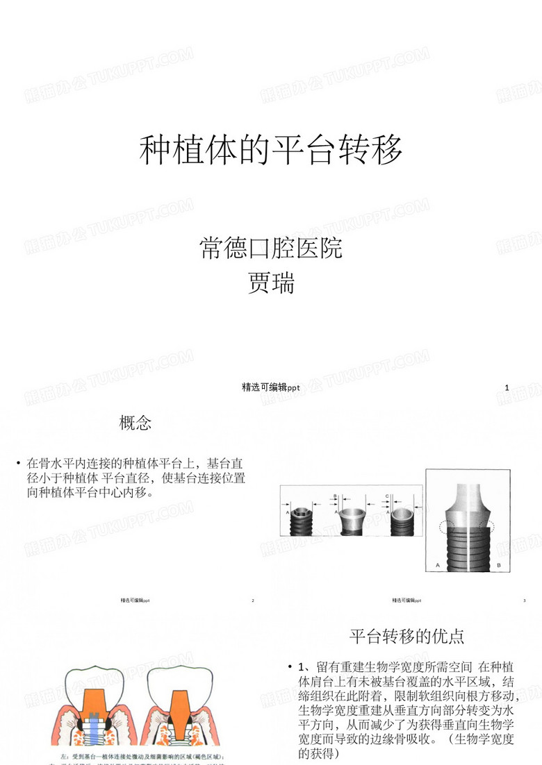 种植体的平台转移
