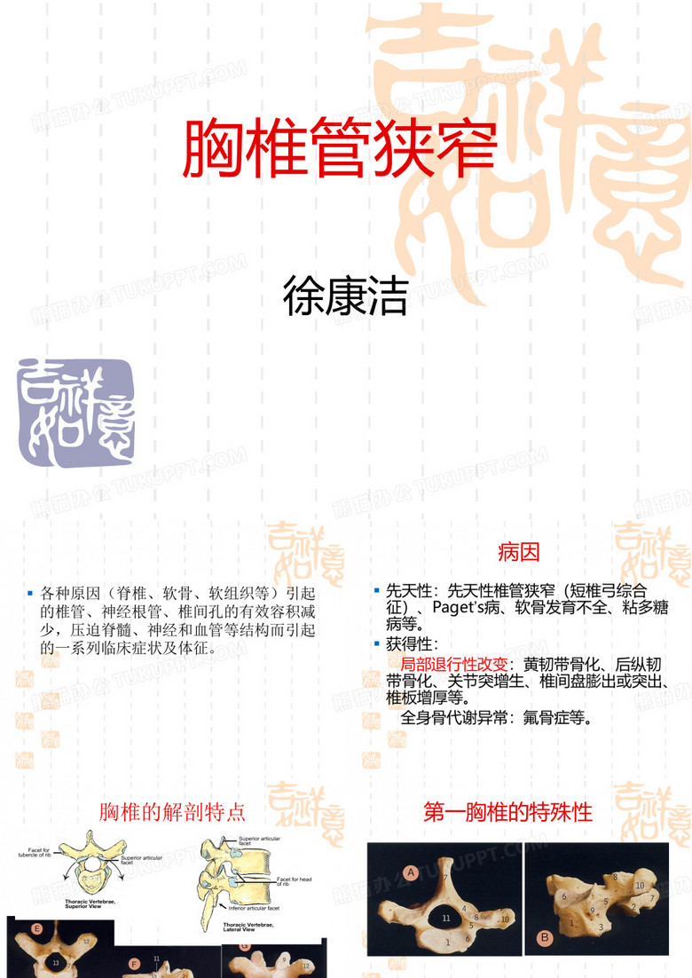 胸椎管狭窄