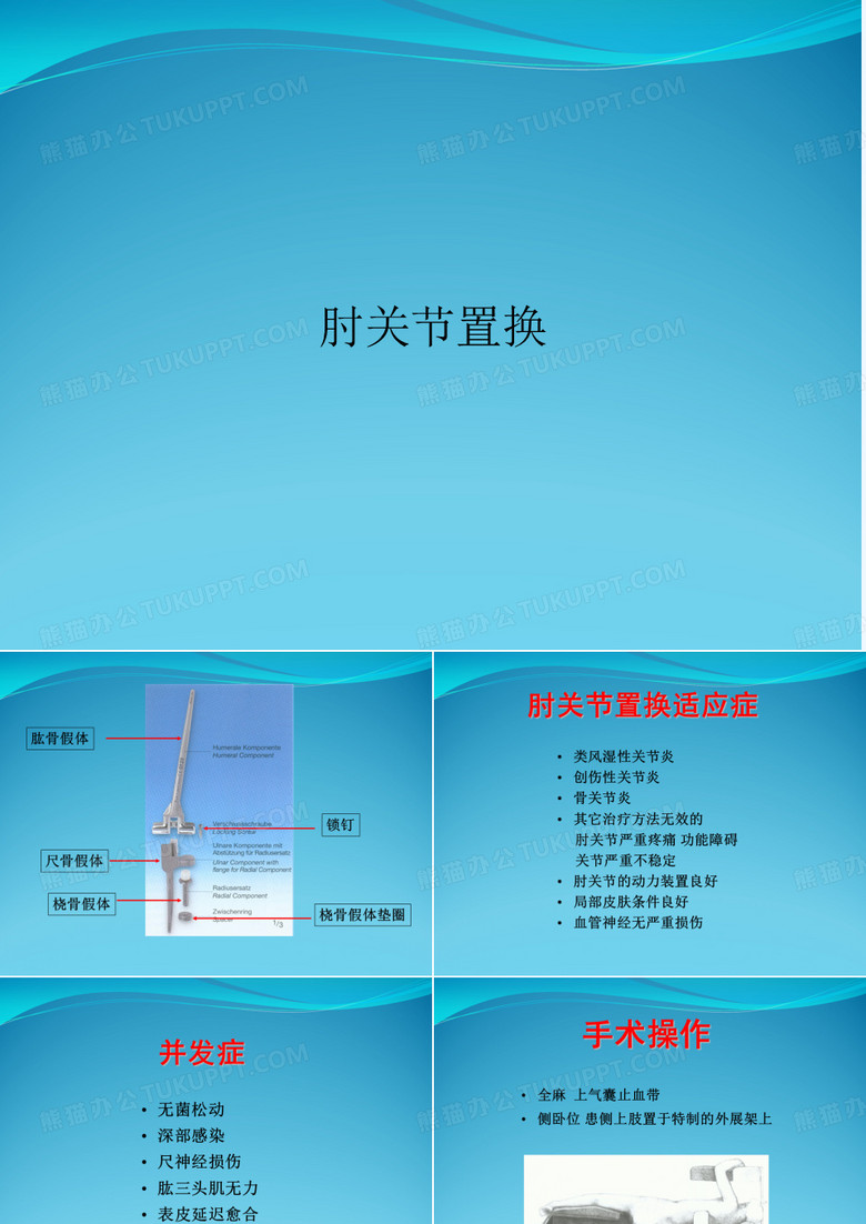 肘关节置换