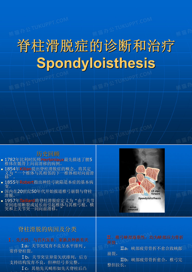 腰椎滑脱症