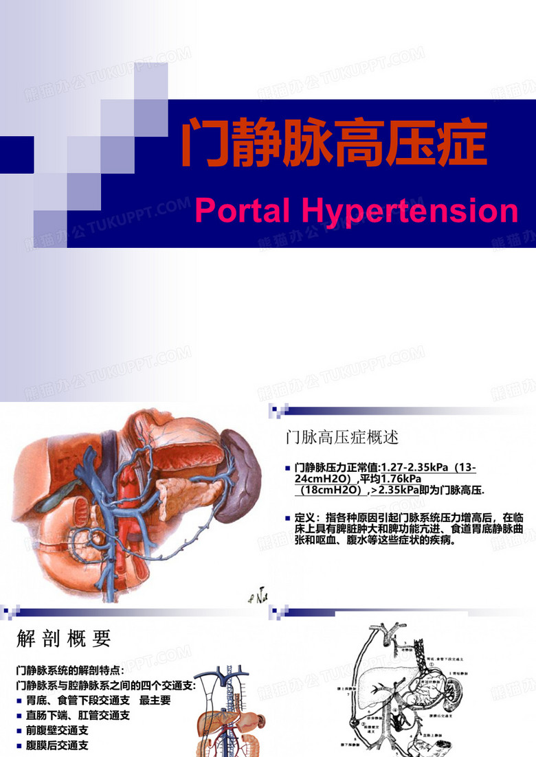 门脉高压课件