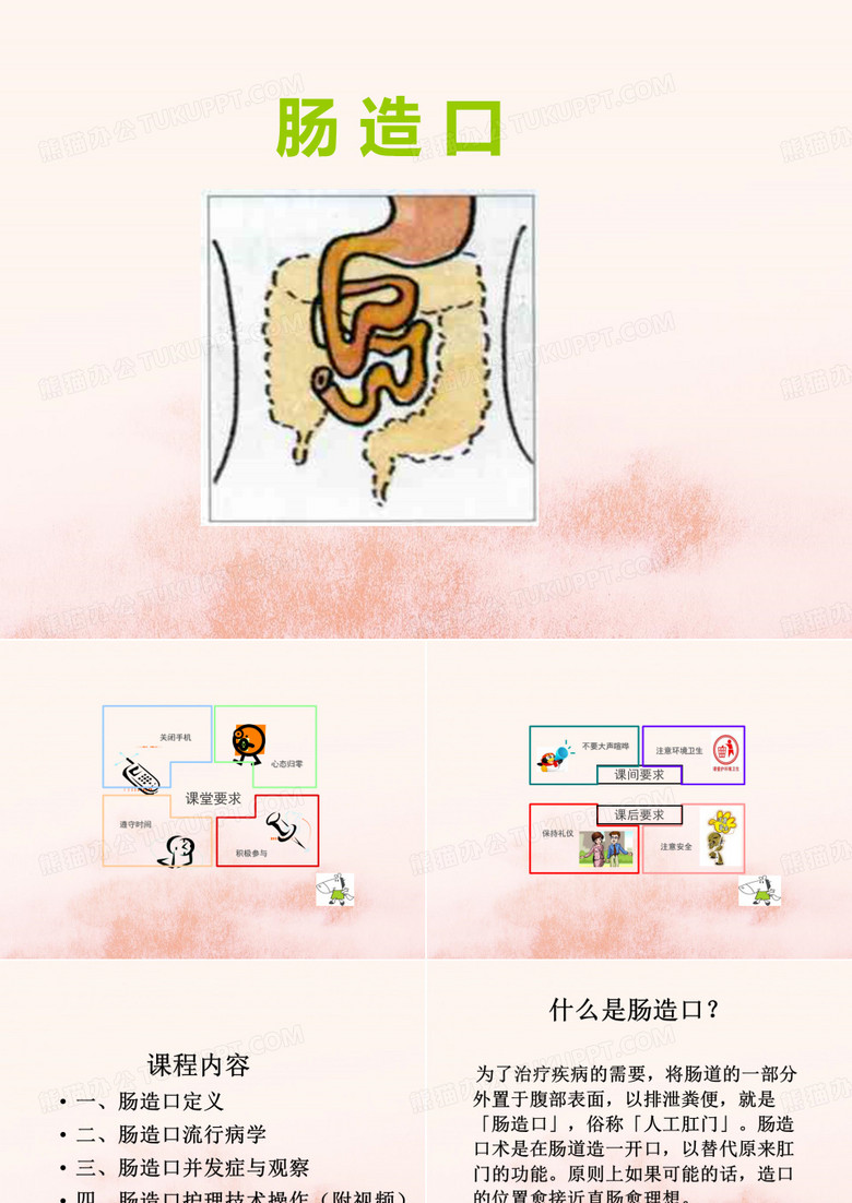 肠造瘘术(实用版)