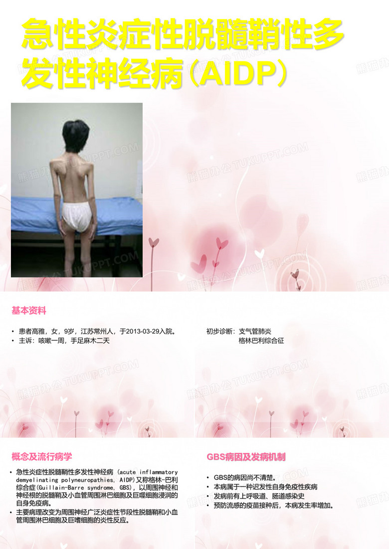 格林巴利综合征