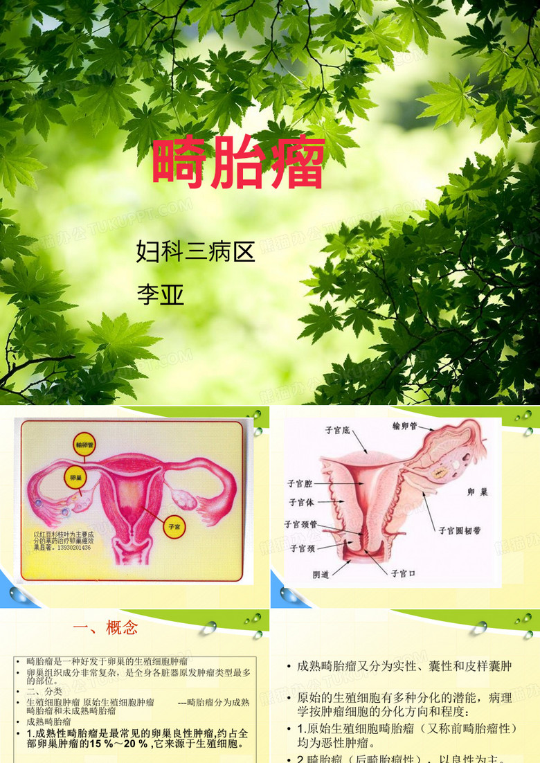 畸胎瘤