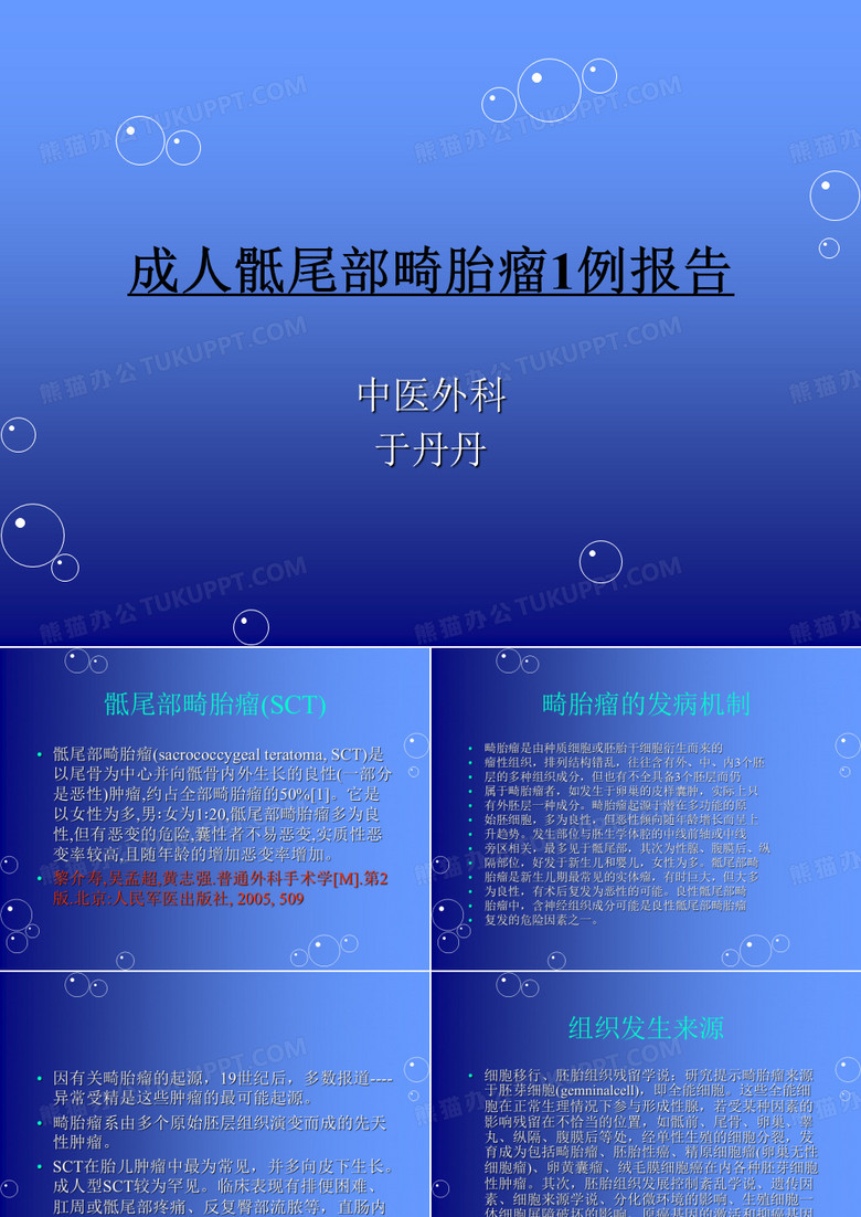 畸胎瘤