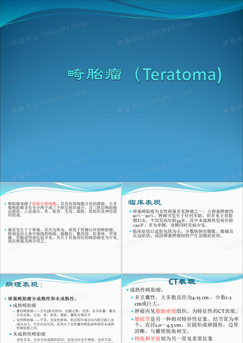 畸胎瘤