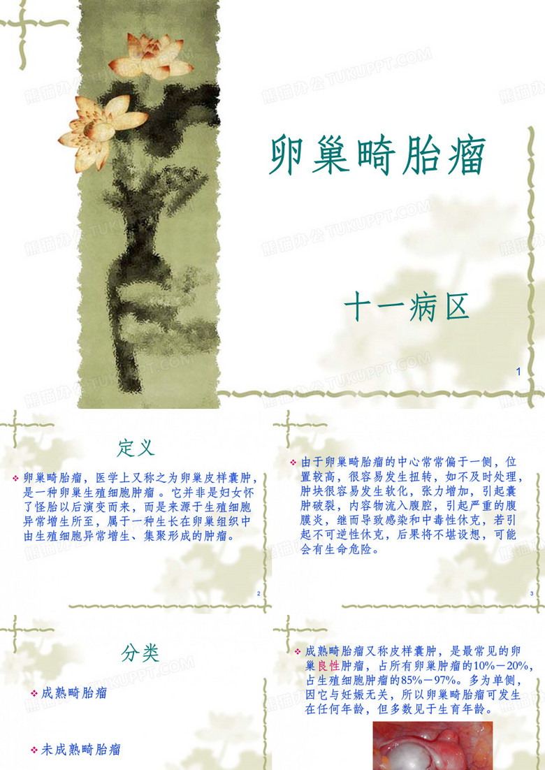 卵巢畸胎瘤